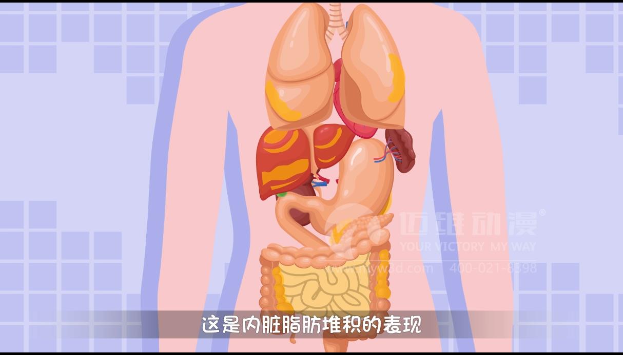MG動畫，邁維動漫.jpg