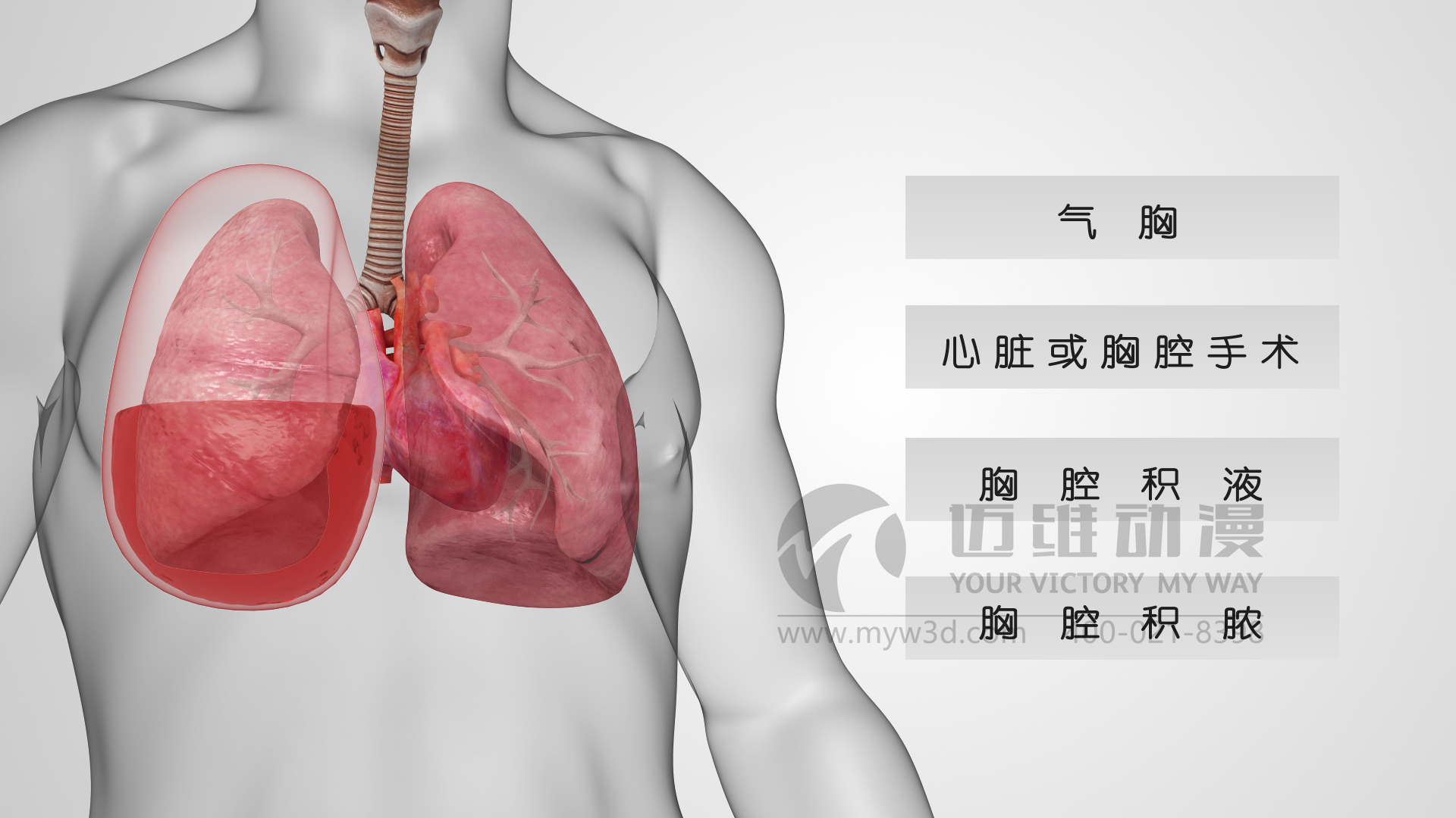 醫(yī)療行業(yè)三維動(dòng)畫，邁維三維動(dòng)畫.jpg