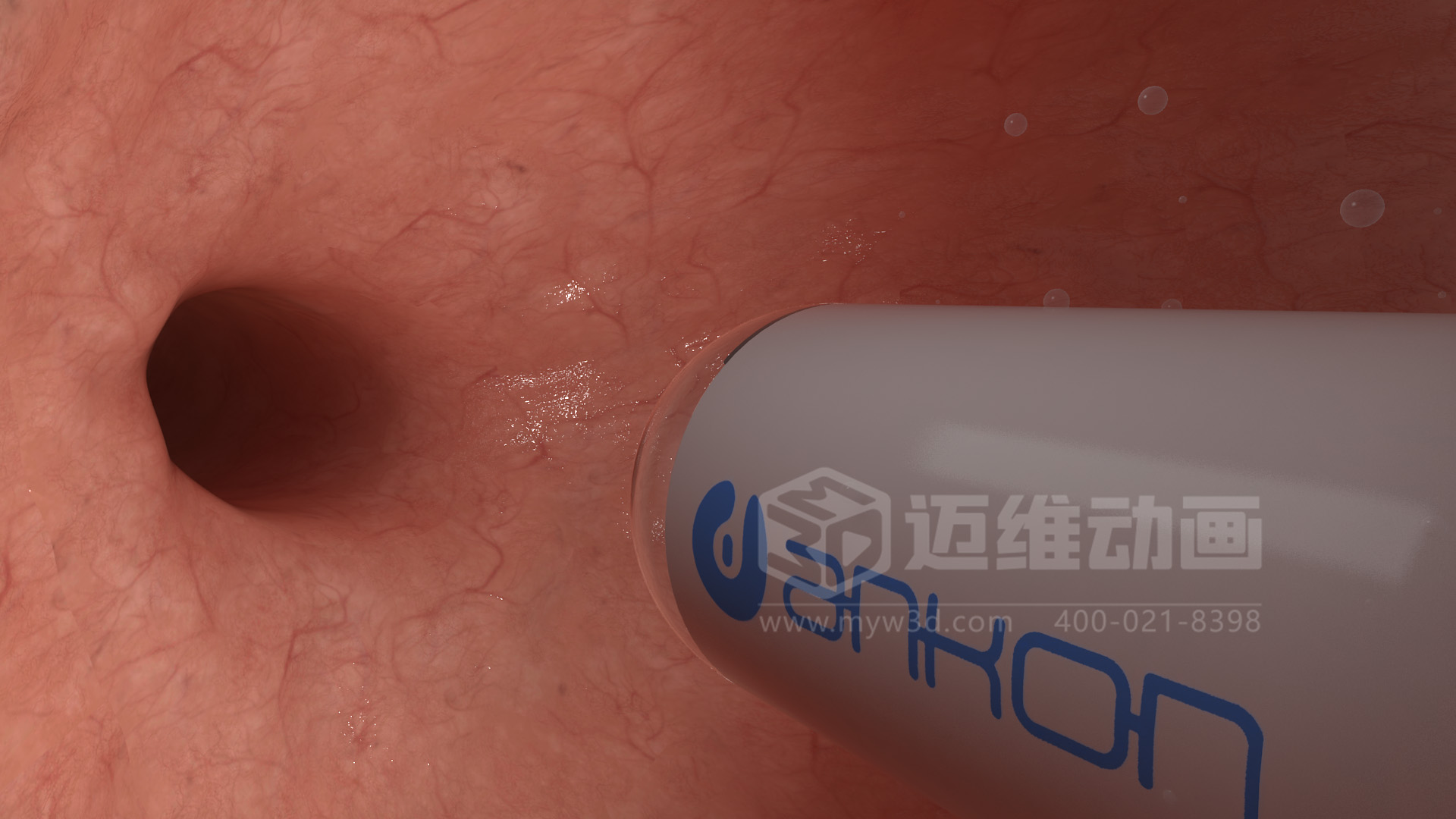 醫(yī)學(xué)檢測(cè)設(shè)備如何突破消化道檢查壁壘？三維動(dòng)畫還原核心技術(shù)與臨床價(jià)值(圖4)